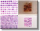 Tissue MicroArray