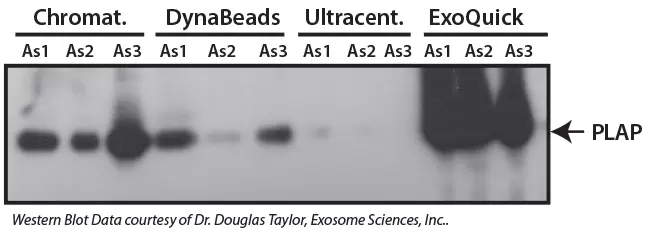 Exoquick High Protein Recovery Ascites Western R