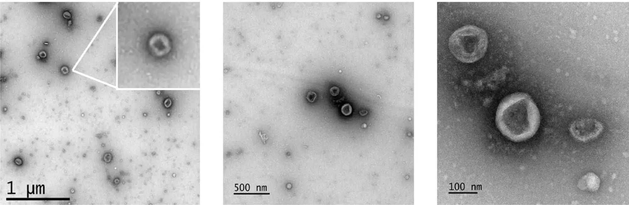 Fig 4 Sev Isolated With Smartsec Delipo Shows Typical Ev Morp 