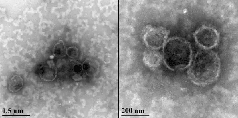 Figure 3 Tem Of Evs Purified With Exoquick Ultra 01
