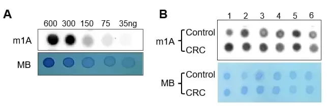M1a Dot Blot Assay Performance